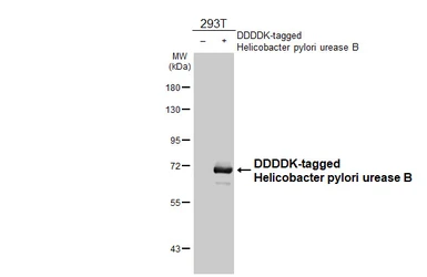 Anti-Helicobacter pylori urease B antibody [HL4569] used in Western Blot (WB). GTX644245